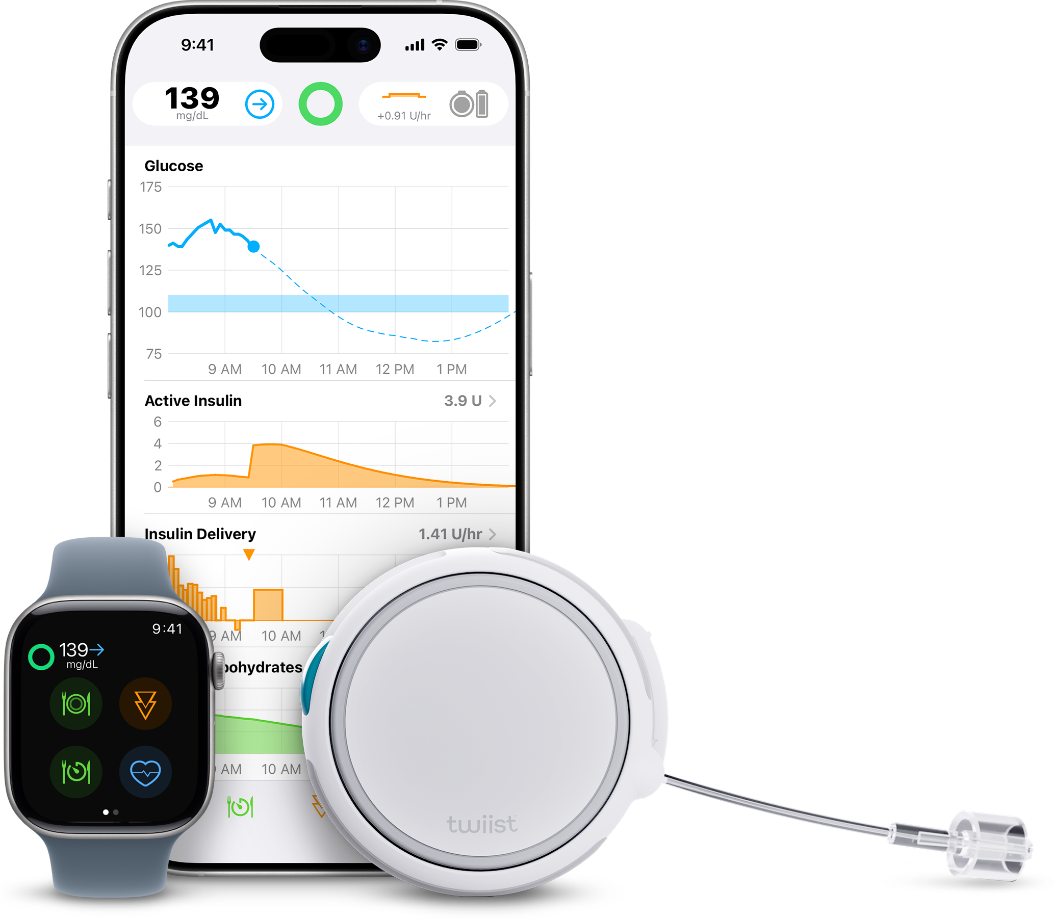 Eversense 365 cgm integrates with twiist automated insulin delivery systems